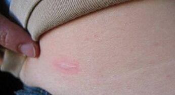 Mal di stomaco: un disturbo del nostro tempo
