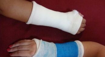 Prevenire l’osteoporosi è possibile