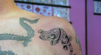 Come funziona il laser per cancellare i tatuaggi?