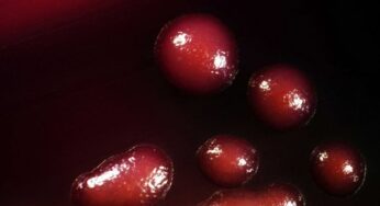 Infezioni da klebsielle, i batteri resistenti agli antibiotici in aumento in Italia