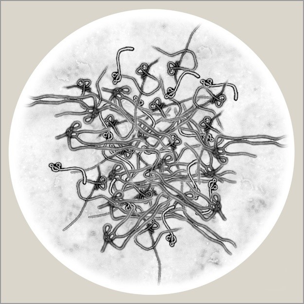 Ebola