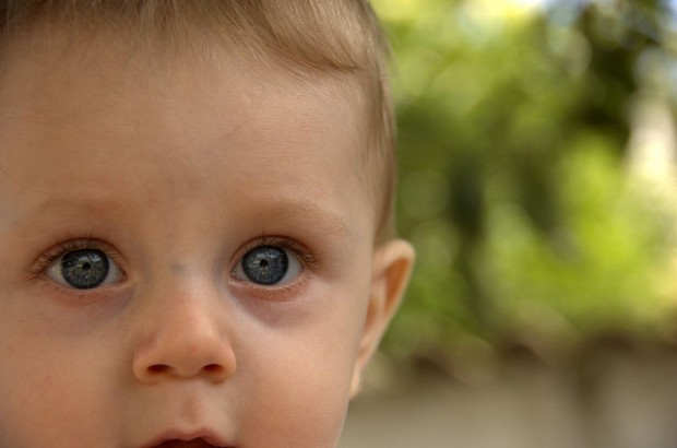 retinoblastoma