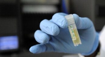 Aids: virus Hiv rimosso da cellule infette