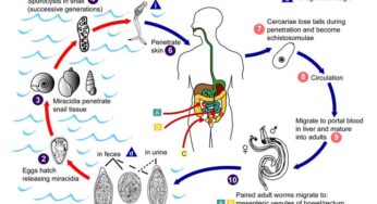 I sintomi della schistosomiasi urinaria, cause e cure