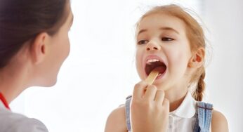 Tonsillite: cosa mangiare e cibi da evitare