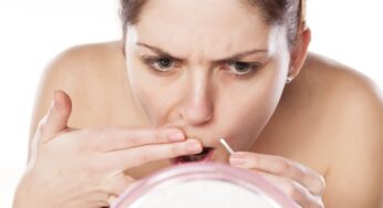 Irsutismo: quali sono le cause?