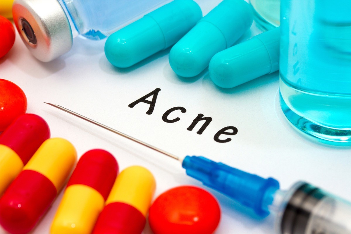 Vaccino per acne