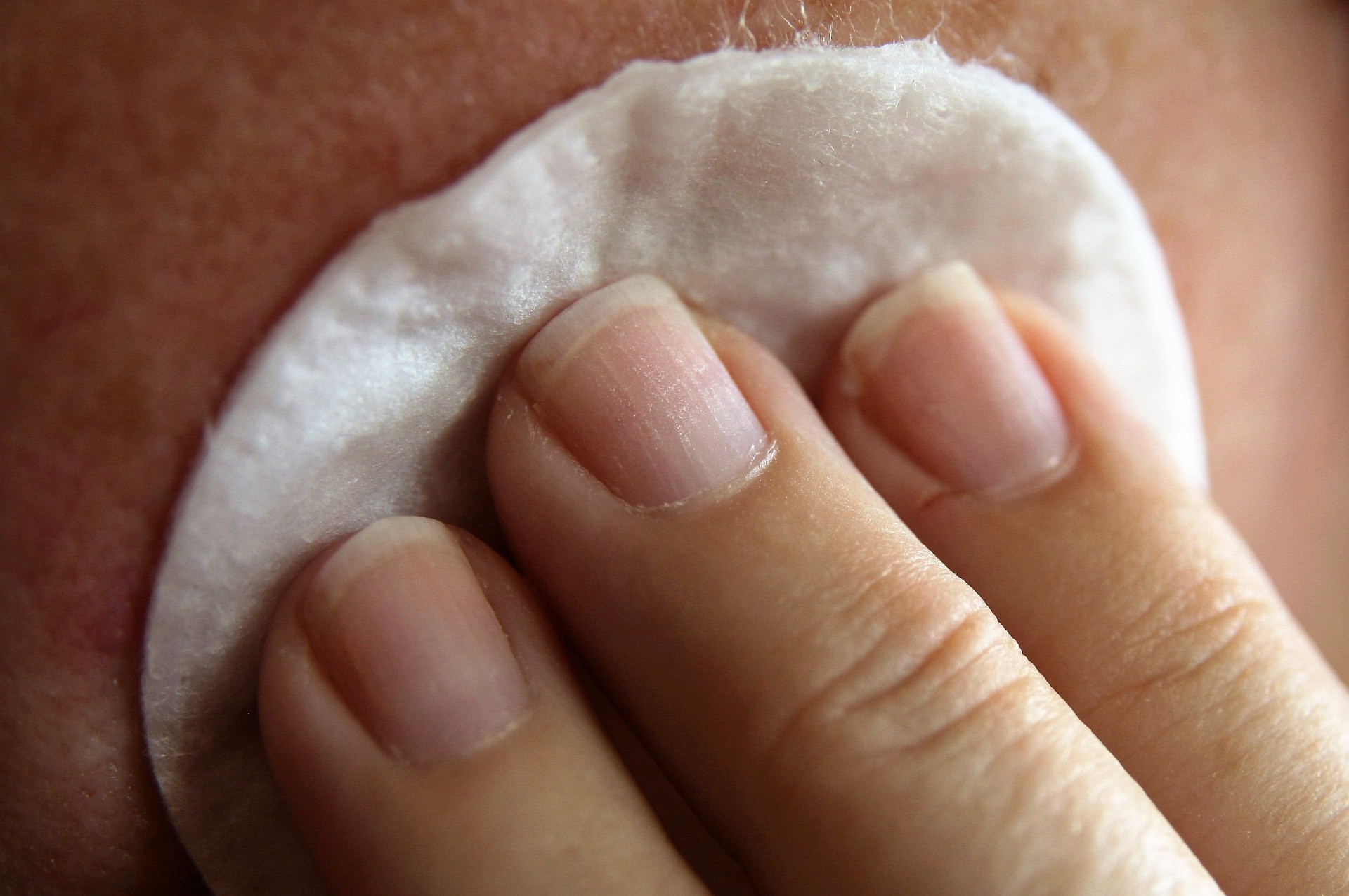 Psoriasi crema