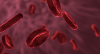 Sindrome da anticorpi antifosfolipidi: sintomi e trattamenti
