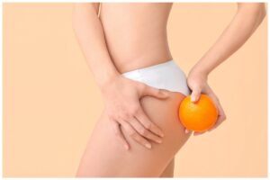 Cellulite eliminala in 20 minuti