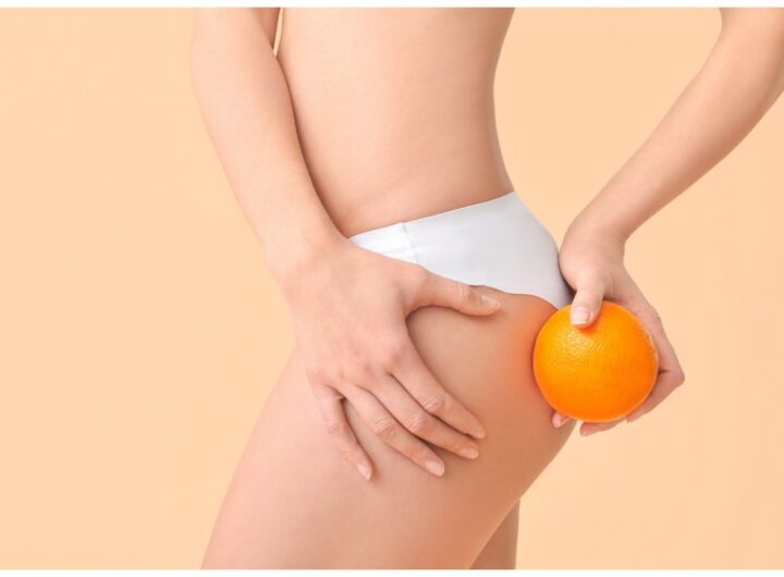 Cellulite eliminala in 20 minuti