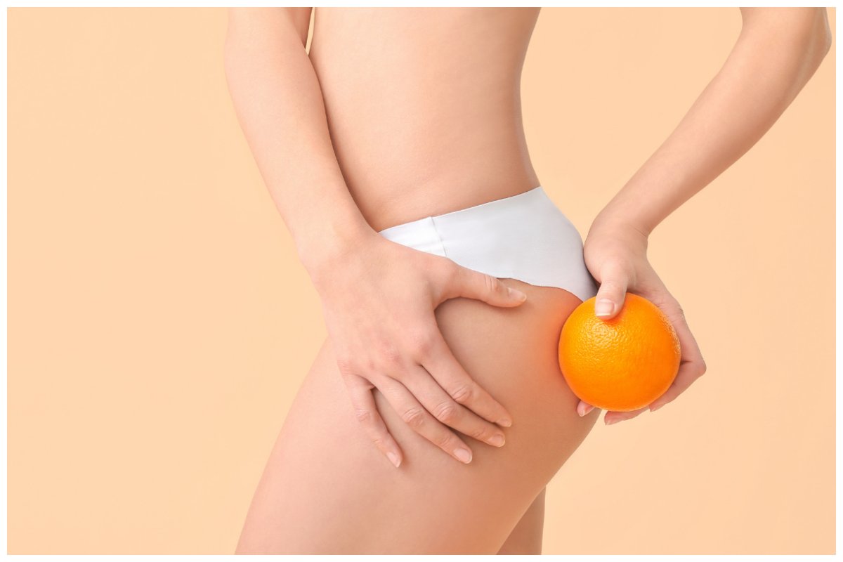 Cellulite eliminala in 20 minuti