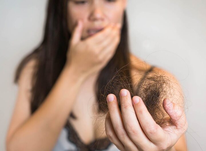 capelli che cadono quando preoccuparsi