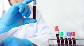 Dovresti fare questi 5 tipi di esame del sangue almeno una volta all’anno: sono molto importanti