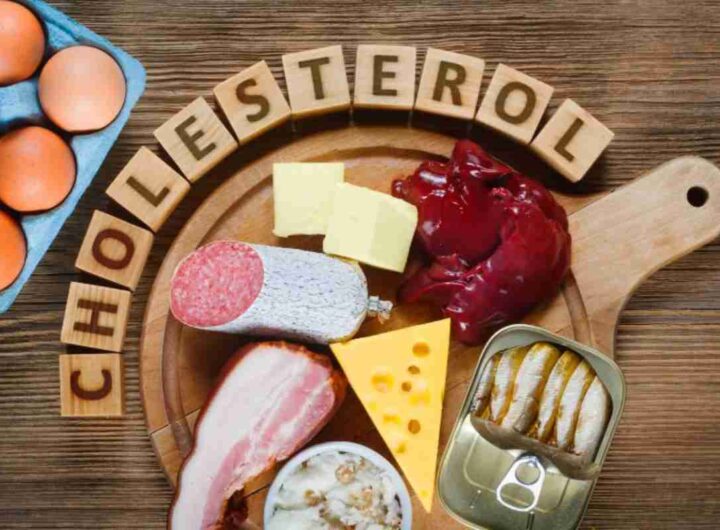 Colesterolo, cibi da evitare