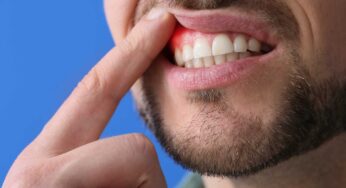 Gengive che sanguinano? Non è solo un problema dentale, ecco cosa potrebbe significare