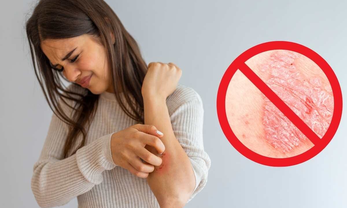 Psoriasi trattamento innovativo