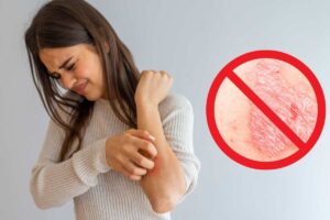 Psoriasi trattamento innovativo