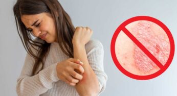 Psoriasi, perché tutti utilizzano la nebulizzazione: come funziona il metodo rivoluzionario che risolve i disturbi